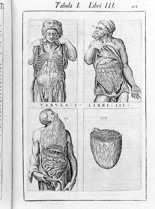 Historia de la composicion del cuerpo humano / Escrita por loan de Valuerde de Hamusco.