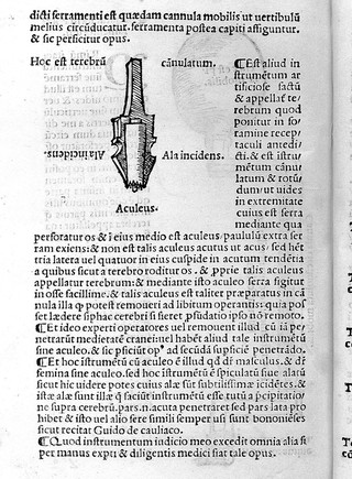 Tractatus de fractura calve sive cranei / a Carpo editus.