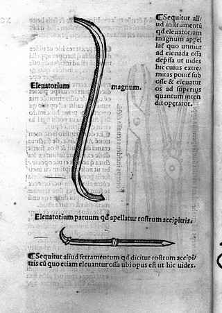 Tractatus de fractura calve sive cranei / a Carpo editus.