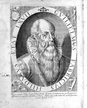 Guilhelmi Fabricii Hildani ... Observationum et curationum chirurgicarum centuriae, nunc primum in unum opus congestae, ac in duo volumina distributae. Quorum prius continet centurias I. II. & III / [Wilhelm Fabricius Hildanus].