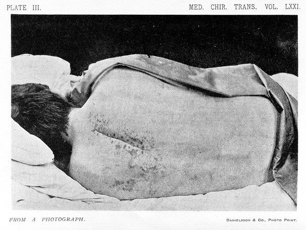 Medico-chirurgical transactions.