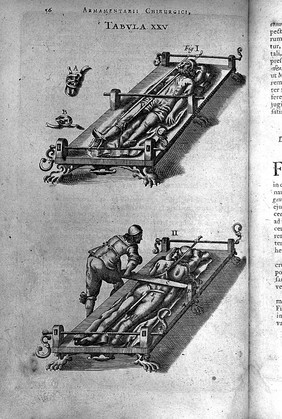 Johannes Scultetus, Armamentarium chirurgicum