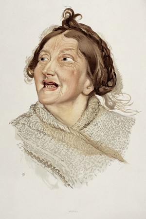 view A woman diagnosed as suffering from hilarious mania. Colour lithograph, 1892, after J. Williamson, 1890.