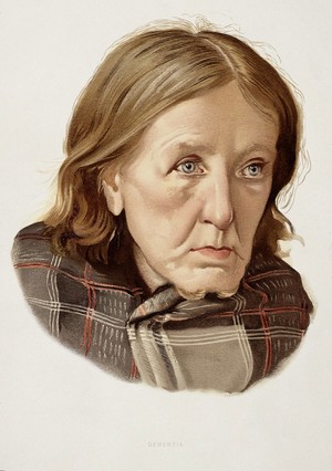 view A woman diagnosed as suffering from chronic dementia. Colour lithograph, 1896, after J. Williamson, ca. 1890.