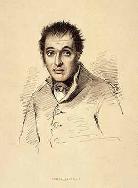 A man diagnosed as suffering from acute dementia. Lithograph, 1892, after a drawing by Alexander Johnston, 1836/1841, for Sir Alexander Morison.