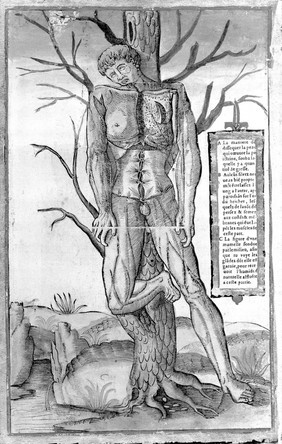 A male écorché standing, leaning against a tree, exposing the anatomy of his thorax and his left breast. Woodcut by François Jollat, 1545, after Étienne de La Rivière and Charles Estienne.