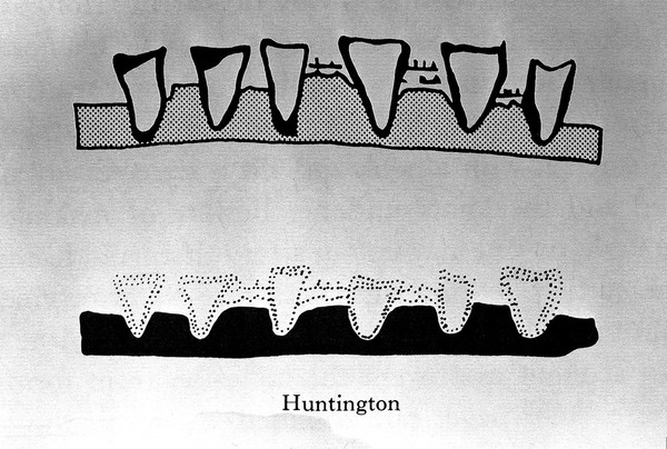 On Surgery and Instruments, 1973