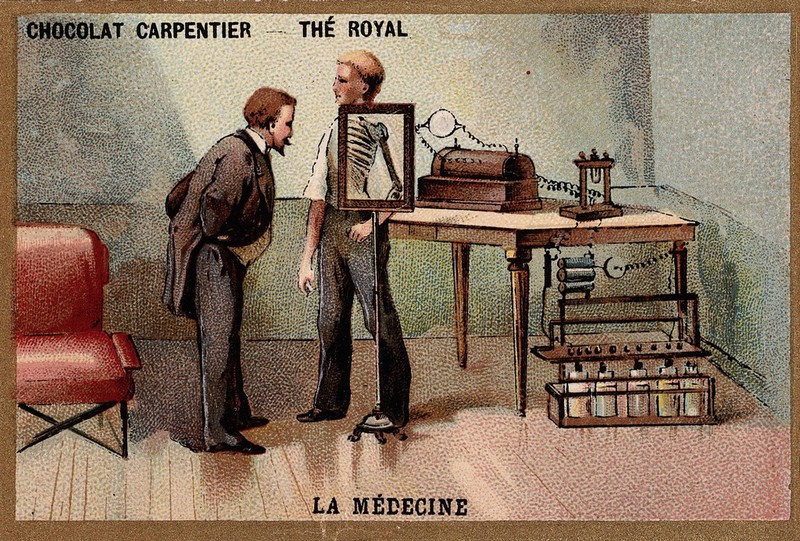 The Invention Of Blinking: A History You Won'T Believe - s6qsphk