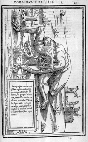 De dissectione partium corporis humani libri tres / à Carolo Stephano, ... Una cum figuris et incisionum declarationibus, a Stephano Riverio chirurgo compositis.