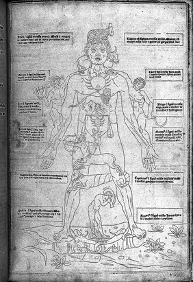 Fasciculus medicine. [F.1a.tit:] Fasciculus medicine in quo continentur: videlicet. ... [F.40b] Hecanothomia fuit emendata ab eximio artium ... Impressum Venetiis per Joannem et Gregorium de Gregoriis fratres. Anno domini Mccccxcv die xv Octobris / [Joannes de Ketham].