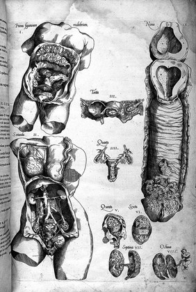 Compendiosa totius anatomiae delineatio aere exarata / [Thomas Geminus].