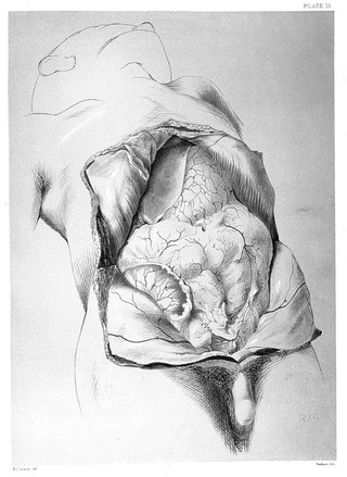 An atlas of human anatomy : illustrating most of the ordinary dissections and many not usually practised by the student / by Rickman John Godlee.