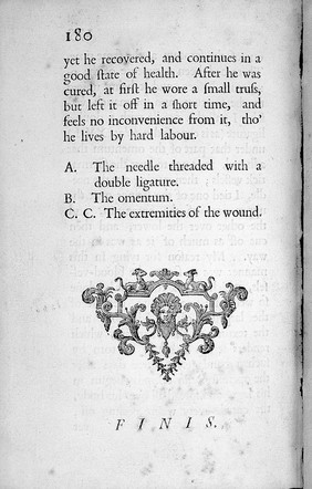 A treatise on the high operation for the stone ... / By William Cheselden.