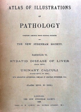 An atlas of illustrations of pathology (fasc. I-XII) / issued by the New Sydenham Society, 1877-1899.