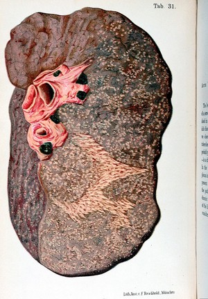 view Dr. O. Bollinger, Atlas and essentials of ph