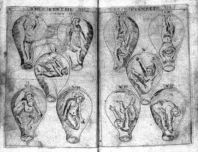 The byrth of mankynde, otherwyse named the womans booke : Newly set furth, corrected and augmented. Whose co[n]tentes ye maye rede in the table of the booke, and most playnly in the prologue / By Thomas Raynold phisition.