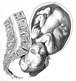 Anatomical tables with explanations, and an abridgement of the practice of midwifery : with a view to illustrate a treatise on that subject, and collection of cases.