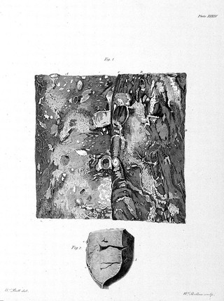 The works of John Hunter ... with notes / Edited by James F. Palmer. [With life and bibliography of Hunter by D. Ottley].