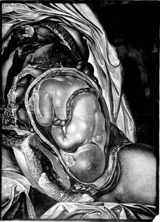 Demonstratio uteri praegnantis mulieris cum foetu ad partum maturi tabulis ... ea methodo dispositis, ut hujus status gravidi amplam ob oculos ideam collecent ... / Ad exemplar Londinense translata a D.C.C. Schmidel. In aes incisa .. a J.M. Seligmanno ... Abbildung der Gebähr-Mutter aus einer schwangern Frau, etc.