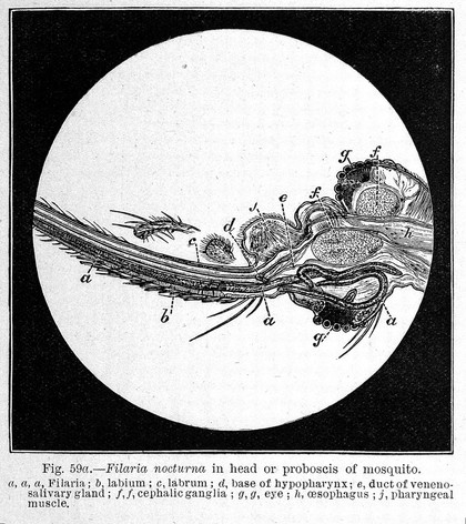 Tropical diseases : a manual of the diseases of warm climates / by Patrick Manson.