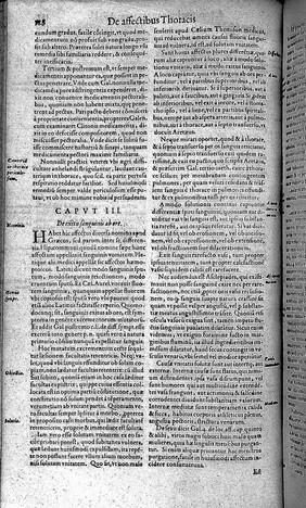 D. Hieron. Mercurialis foroliviensis ... Medicina practica, seu de cognoscendis, discernendis, et curandis omnibus humani corporis affectibus, earumqúe causis indagandis, libri V, in Patavino gymnasio, olim ab ipso publice praelecti, et thesauri instar a quibusdam hactenus reconditi, plurimorumqúe votis & desiderio summè expetiti / nunc autem postobitum autoris, publici boni causa, in lucem editi, studio et opera Petri de Spina.