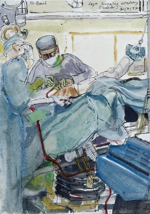 view A surgical operation: left scapular osteotomy. Drawing by Virginia Powell, 1997.