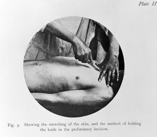 Post-mortem methods / by J. Martin Beattie.