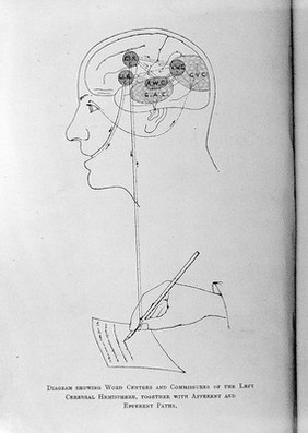 A treatise on aphasia and other speech defects / by H. Charlton Bastian.