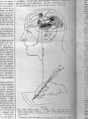 view Le Progres medical, Journal de medicine, 1888