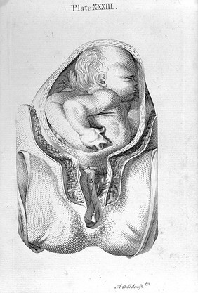 A set of anatomical tables with explanations and an abridgment of the practice of midwifery / [William Smellie].