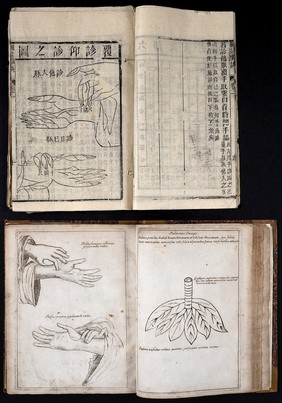 Specimen medicinae Sinicae, sive opuscula medica ad mentem Sinensium, continens: I. De pulsibus libros quatuor e Sinico translatos; II. Tractatus de pulsibus ab erudito Europaeo collectos; III. Fragmentum operis medici ibidem ab erudito Europaeo conscripti; IV. Excerpta literis eruditi Europaei in China; V. Schemata ad meliorem praecedentium intelligentiam; VI. De indiciis morborum ex linguae coloribus et affectionibus / ... Edidit Andreas Cleyer.