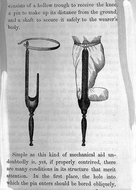 Simple wooden leg - Henry Heather Bigg