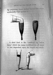 Socket leg and artificial leg below the knee | Wellcome Collection