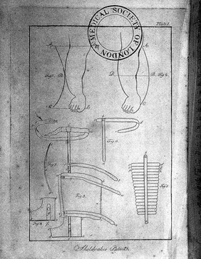 A practical essay on the club-foot, and other distortions in the legs and feet of children, intended to shew under what circumstances they are curable, or otherwise; with thirty-one cases that have been ... treated by the method for which the author has obtained the King's patent, and the specification of the patent for that purpose ... As well as for curing distortions of the spine, and every other deformity that can be remedied by mechanical applications / By T. Sheldrake.