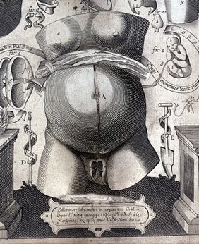 An exact survey of the microcosmus or little world : being an anatomie, of the bodies of man and woman wherein the skin, veins, nerves, muscles, bones, sinews and ligaments are accurately delineated. And curiously pasted together, so as at first sight you may behold all the outward parts of man and woman. And by turning up the several dissections of the paper take a view of all their inwards. With alphabetical referrences [sic] to every member and part of the body. Usefull for all doctors, chirurgeons, &c. As also for painters, carvers, and all persons that desire to be acquainted with the parts, and their names, in the bodies of man, or woman / [Johann Remmelin] ; Set forth by Michael Spaher of Tyrol ; And English'd by John Ireton ; And lastly perused and corrected, by several rare anatomists.