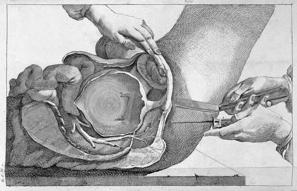 Dictionnaire universel de medecine, de chirurgie, de chymie, de botanique, de pharmacie, d'histoire naturelle, etc / Précédé d'un discours historique sur l'origine et les progres de la medecine. Traduit de l'anglois ... par Mrs Diderot, Eidous et Toussaint. Revu, corrigé et augmenté par M.J. Busson.