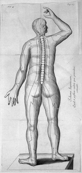 A treatise on acupuncturation; being a description of a surgical operation originally peculiar to the Japonese [sic] and Chinese, and by them denominated Zin-King, now introduced into European practice, with directions for its performance, and cases illustrating its success / [James Morss Churchill].