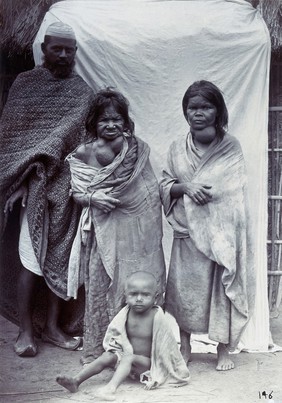 Two women with goitres, with a man and a child, in Naini Tal, Uttar Pradesh. Photograph.