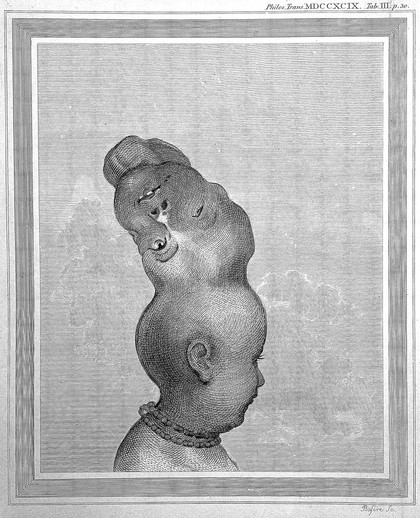An account of a child with a double head / [Sir Everard Home].