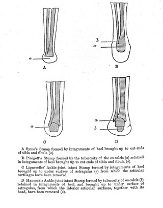 H. Hancock, On the operative surgery of the