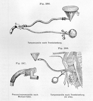 Esmarch & Kowalzig, Chirurgische Technik