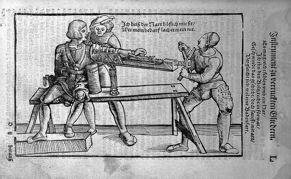 Gersdorff, Feldtbuch der Wundartzney, 1527