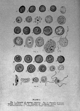 Tropical Diseases, Parasite of quatan infection.