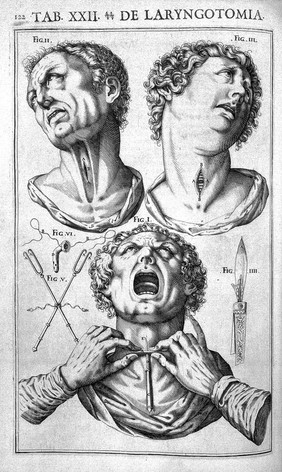 Julii Casserii Placentini ... De vocis auditusque organis historia anatomica singulari fide methodo ac industria concinnata tractatibus duobus explicata ac variis iconibus aere excusis illustrata / [Giulio Cesare Casseri].