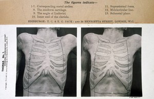 view The Edinburgh steroscopic atlas of anatomy