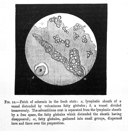 J.M. Charcot, Lectures on the diseases of th