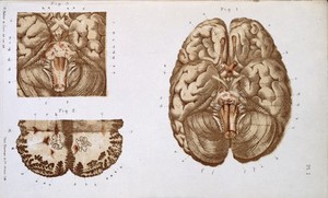 view J. M. Charcot, Diseases of the nervous syste