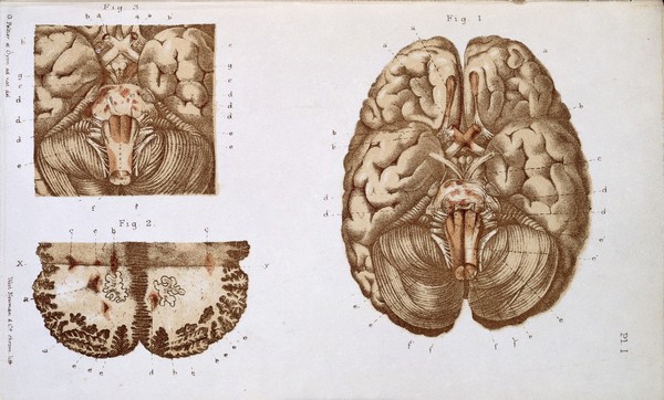 J. M. Charcot, Diseases of the nervous syste