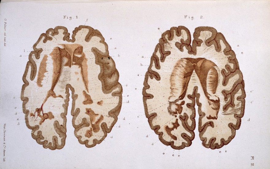 J. M. Charcot, Diseases of the nervous syste