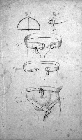 Hints for the improvement of trusses; intended to render their use less inconvenient, and to prevent the necessity of an understrap. With the description of a truss of easy construction and slight expence [sic], for the use of labouring poor / [James Parkinson].